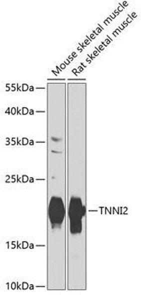 Troponin I2 (TNNI2) Rabbit Polyclonal Antibody (CAB7937)