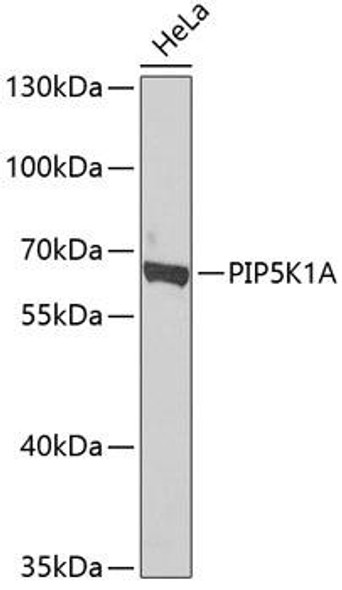 PIP5K1A Rabbit Polyclonal Antibody (CAB7941)