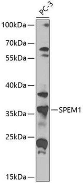 SPEM1 Rabbit Polyclonal Antibody (CAB8076)