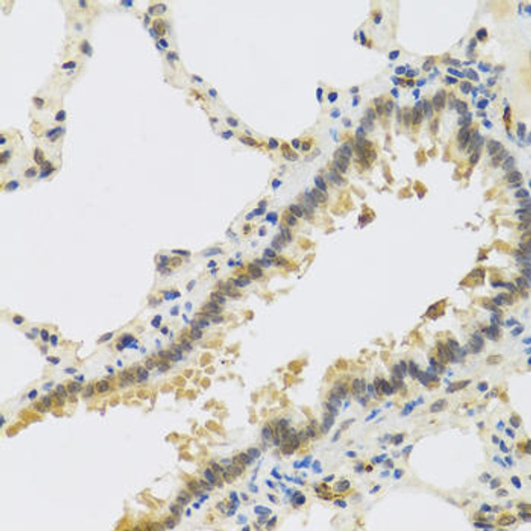 RSPO1 Rabbit Polyclonal Antibody (CAB8289)