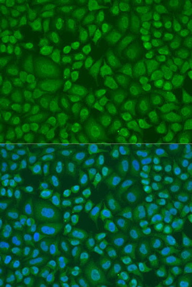 DROSHA Rabbit Polyclonal Antibody (CAB8336)