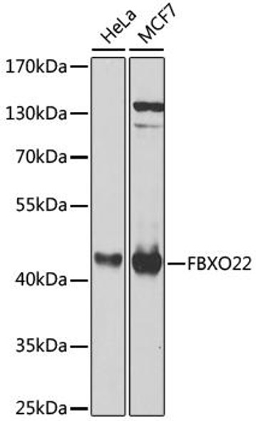 FBXO22 Rabbit Polyclonal Antibody (CAB8367)