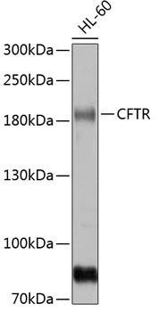 CFTR Rabbit Polyclonal Antibody (CAB8386)