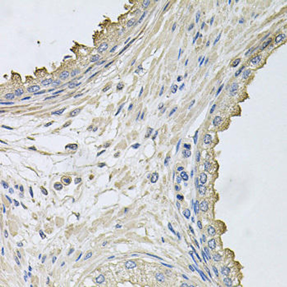 HERC3 Rabbit Polyclonal Antibody (CAB8567)