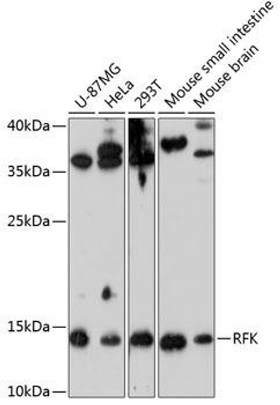 RFK Rabbit Polyclonal Antibody (CAB9141)