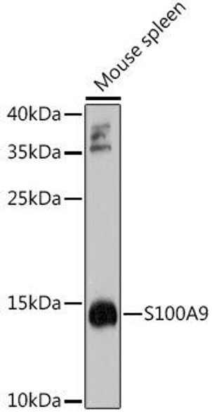 S100A9 Rabbit Polyclonal Antibody (CAB9842)