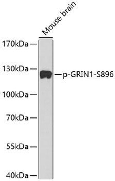 Phospho-NMDAR1-S896 Rabbit Polyclonal Antibody (CABP0165)