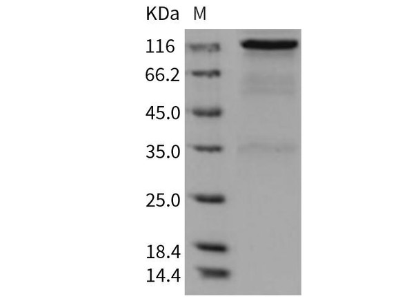 Rat HER2/ErbB2 Recombinant Protein (Fc Tag) (RPES0142)