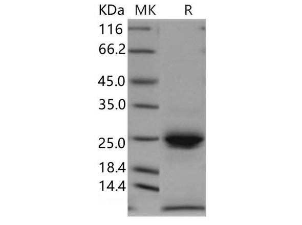Human Kallikrein 6/KLK6 Recombinant Protein (RPES0275)
