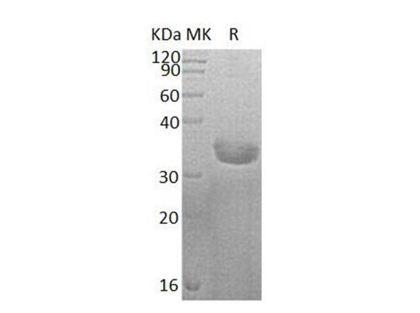 Human SULT1C2 Recombinant Protein (RPES0319)