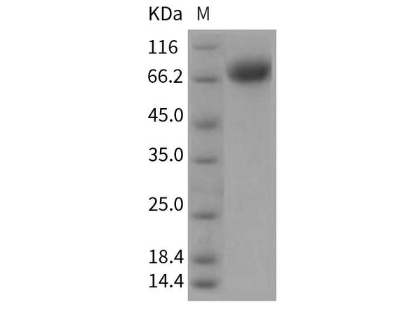 Rat BCAM Recombinant Protein (His Tag) (Active) (RPES0331)