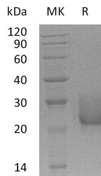Human CEACAM7/CGM2 Recombinant Protein (RPES0356)