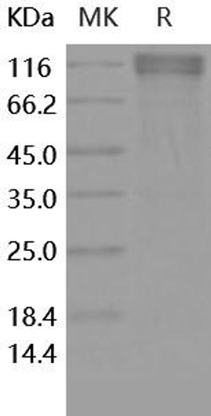 Human ECE-2 Recombinant Protein (RPES0368)