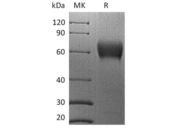 Human B7-H5/Gi24/VSIR Recombinant Protein (RPES0517)