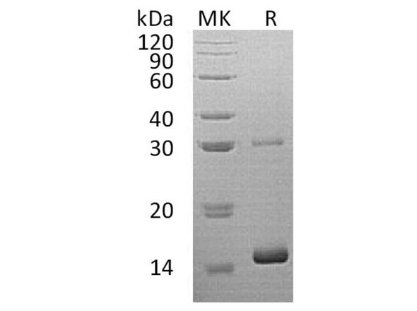 Human HBQ1 Recombinant Protein (RPES0530)
