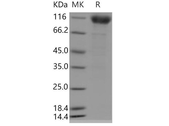 Human IFNAR1/IFNAR Recombinant Protein (Fc Tag) (RPES0692)