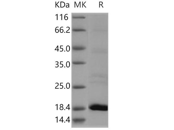 Human Flavokinase/RFK Recombinant Protein (RPES0760)