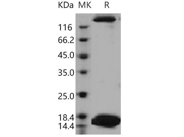 Human SPEG/APEG Recombinant Protein (RPES0870)