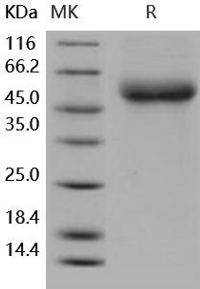 Human IL18RAP/IL1R7 Recombinant Protein (His Tag) (Active) (RPES0892)