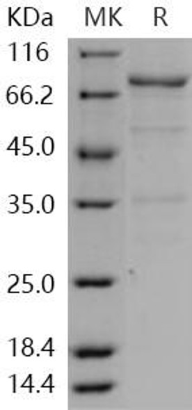 Human c-Yes/YES1 Recombinant Protein (His & GST Tag) (Active) (RPES1085)