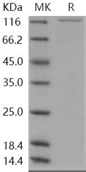 Human MAP4K5/MEKKK5 Recombinant Protein (His & GST Tag) (RPES1104)