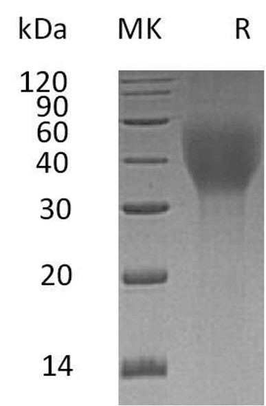 Human TCblR/8D6A Recombinant Protein (RPES1135)