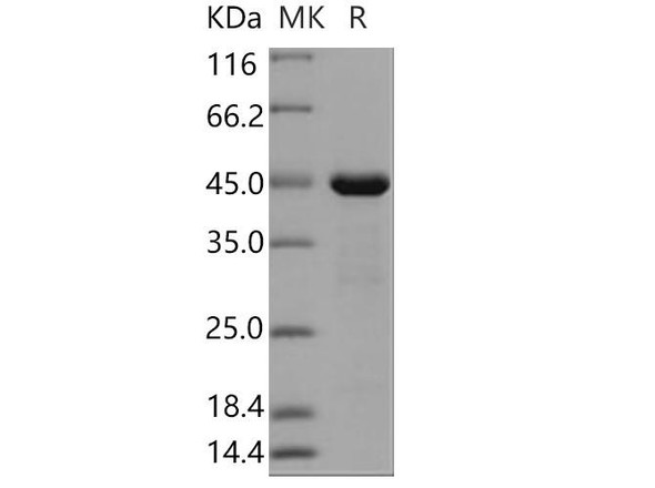 Human PRL-2/PTP4A2 Recombinant Protein (GST Tag) (RPES1181)