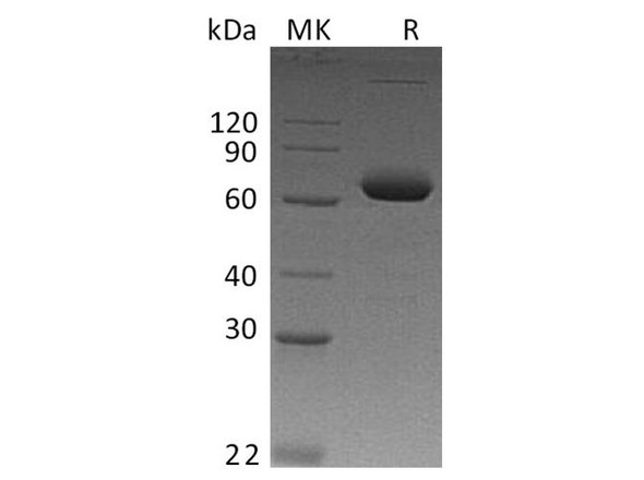 Human IL-2RB/CD122 Recombinant Protein (RPES1189)
