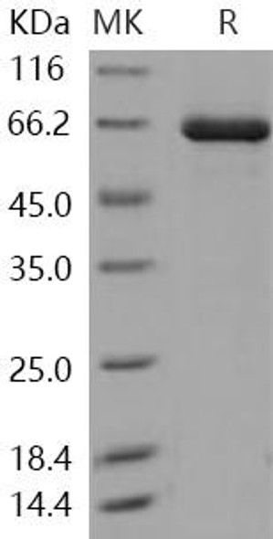 Human TLK2/PKU-ALPHA Recombinant Protein (His&GST Tag) (RPES1248)