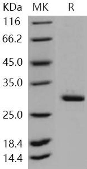 Human METTL1 Recombinant Protein (His Tag) (RPES1287)