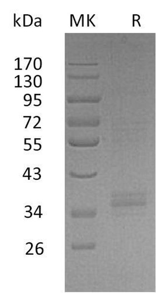 Human TREML2/TLT2 Recombinant Protein (RPES1351)