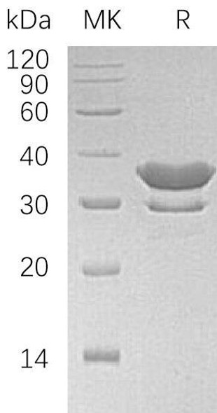 Human SULT2A1 Recombinant Protein (His Tag) (RPES1404)