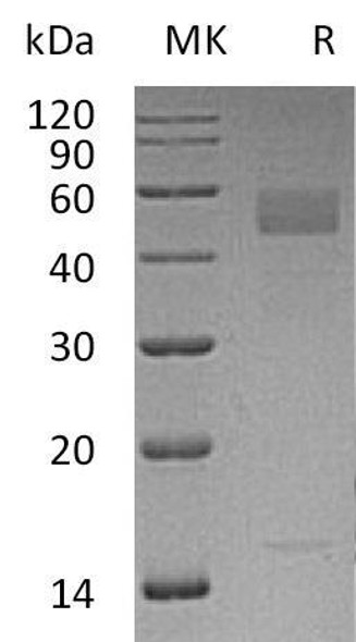 Inhibin Beta C Chain/INHBC Recombinant Protein (RPES1407)