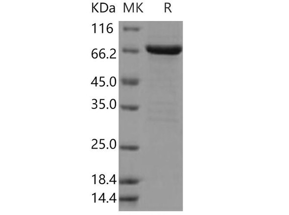 Human FGFR2/CD332 Recombinant Protein (aa 400-821, His & GST Tag) (Active) (RPES1437)