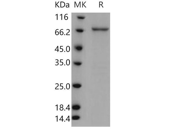 Human TPL2/MAP3K8/MEKK8 Recombinant Protein (GST Tag) (RPES1456)