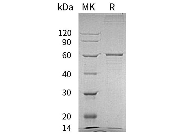 Human BLK Recombinant Protein (RPES1464)