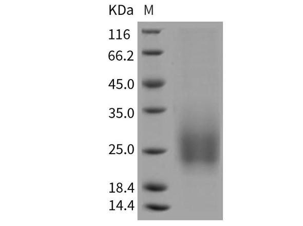 Mouse TALLA/TSPAN7 Recombinant Protein (His Tag) (RPES1468)