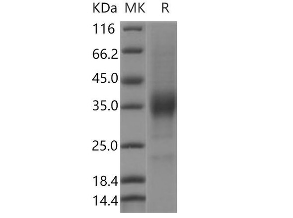 Human KIR2DL4/CD158D Recombinant Protein (RPES1496)