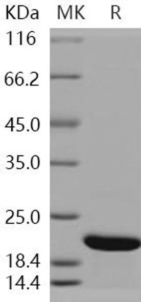 Human CFL2/cofilin 2/ADF Recombinant Protein (His Tag) (RPES1497)