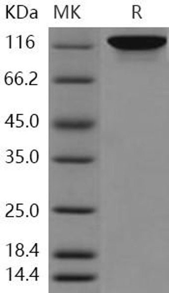 Human Autotaxin/ENPP2 Recombinant Protein (RPES1521)