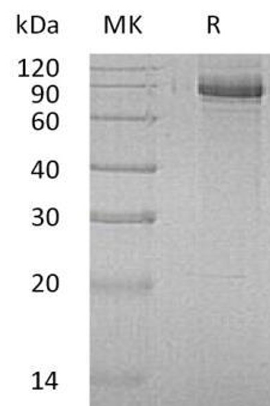 Human INPP1 Recombinant Protein (RPES1524)