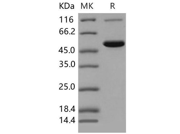 Mouse CES2 Recombinant Protein (RPES1598)