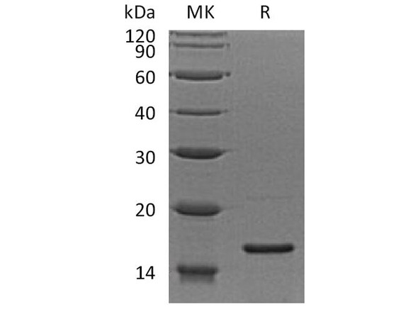 Human RPS19 Recombinant Protein (RPES1639)
