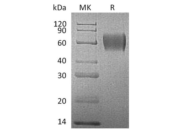 Human IL17RA Recombinant Protein (RPES1710)