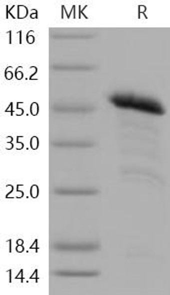 Human PRDM2/RIZ1 Recombinant Protein (GST Tag) (RPES1719)