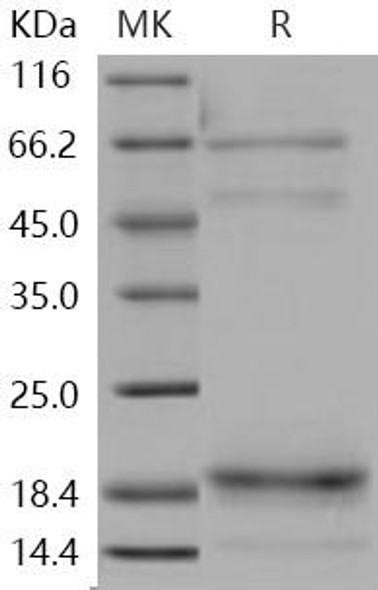 Human Cochlin/COCH Recombinant Protein (His Tag) (RPES1794)