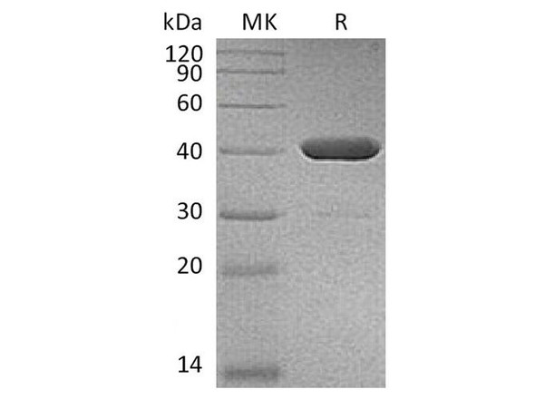 Human IDO2 Recombinant Protein (RPES2050)