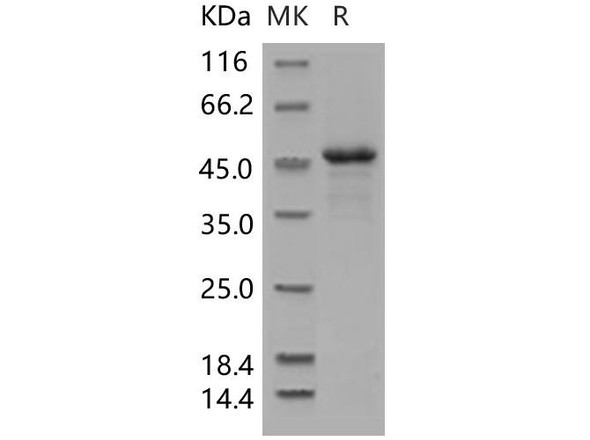 Human ILKAP Recombinant Protein (His Tag) (RPES2073)