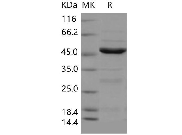 Human NEIL1 Recombinant Protein (His Tag) (RPES2094)