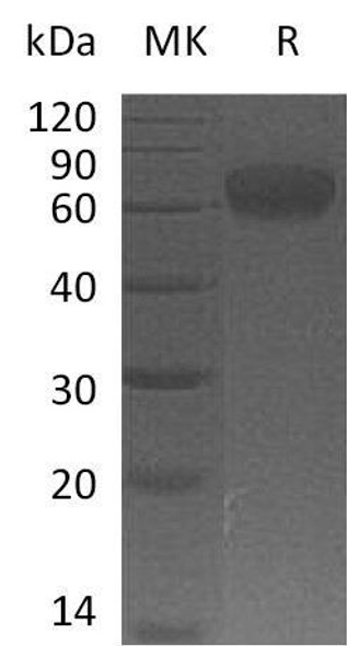 Human B7-H5/Gi24/VSIR Recombinant Protein (RPES2103)